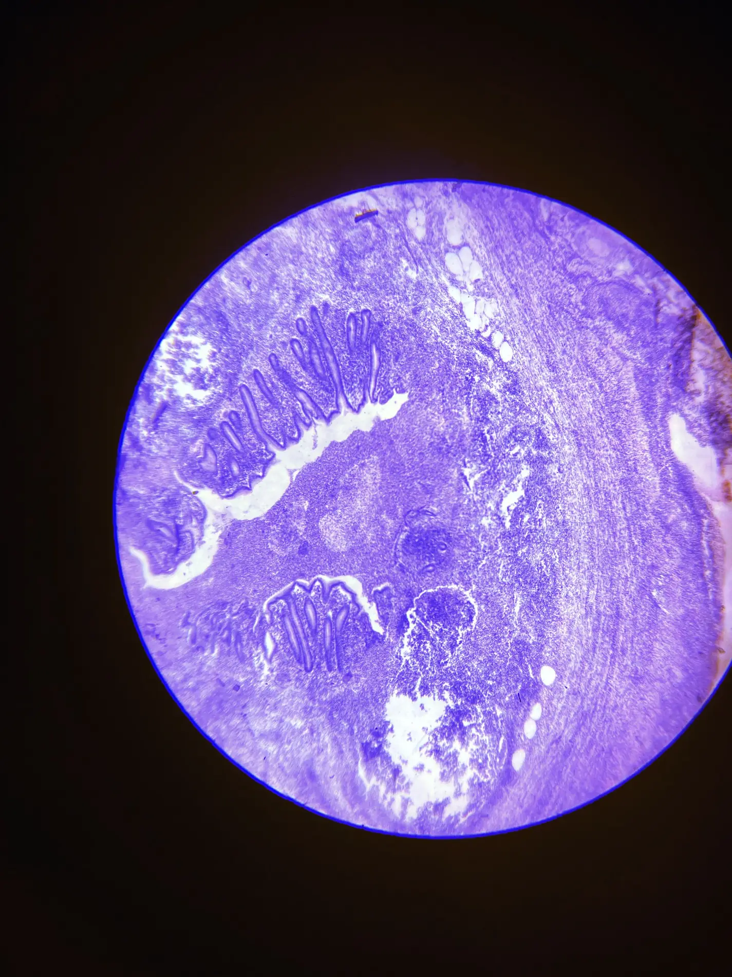 Stained tissue section under a microscope