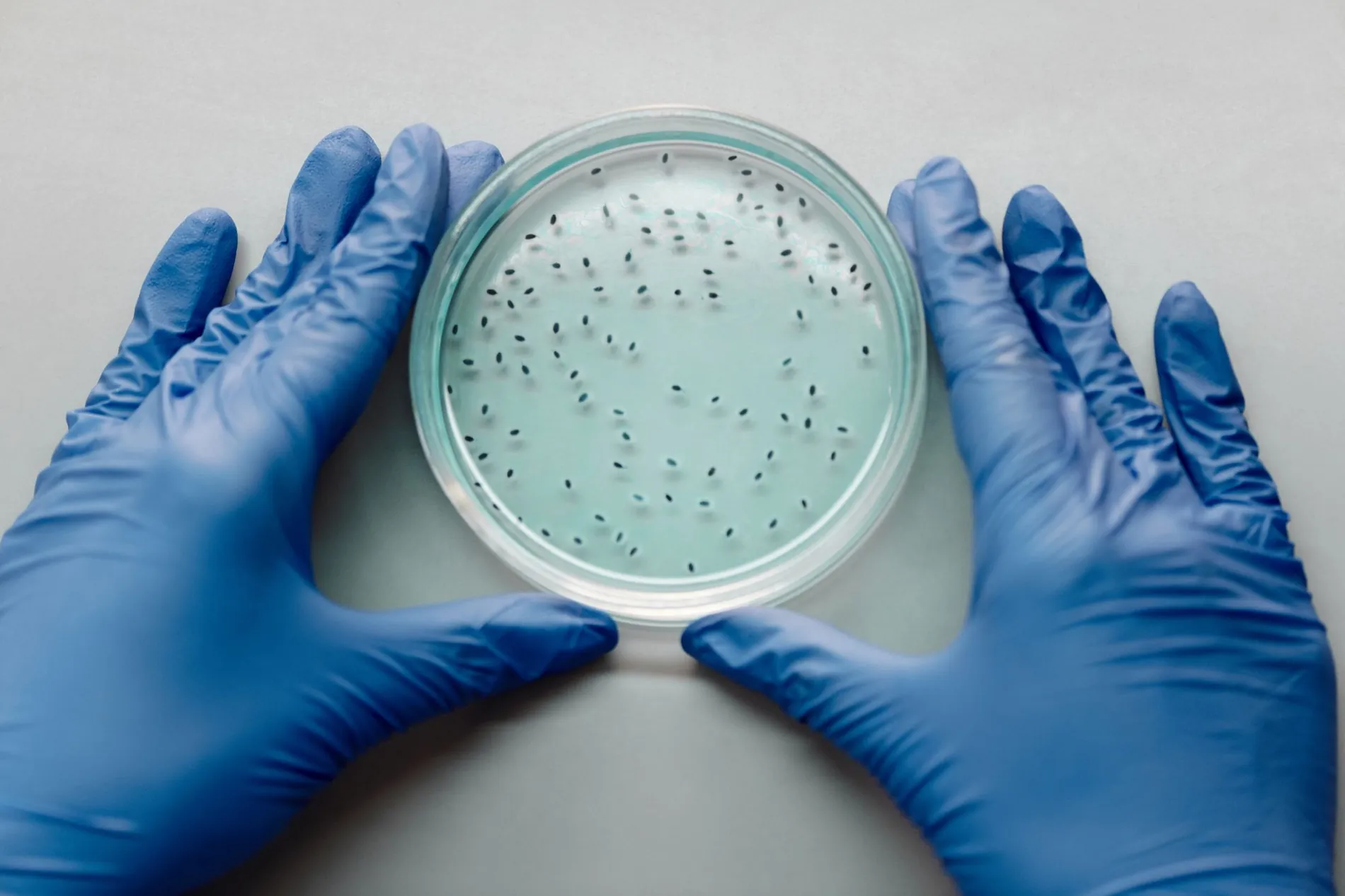How exosomes are isolated: the main methods