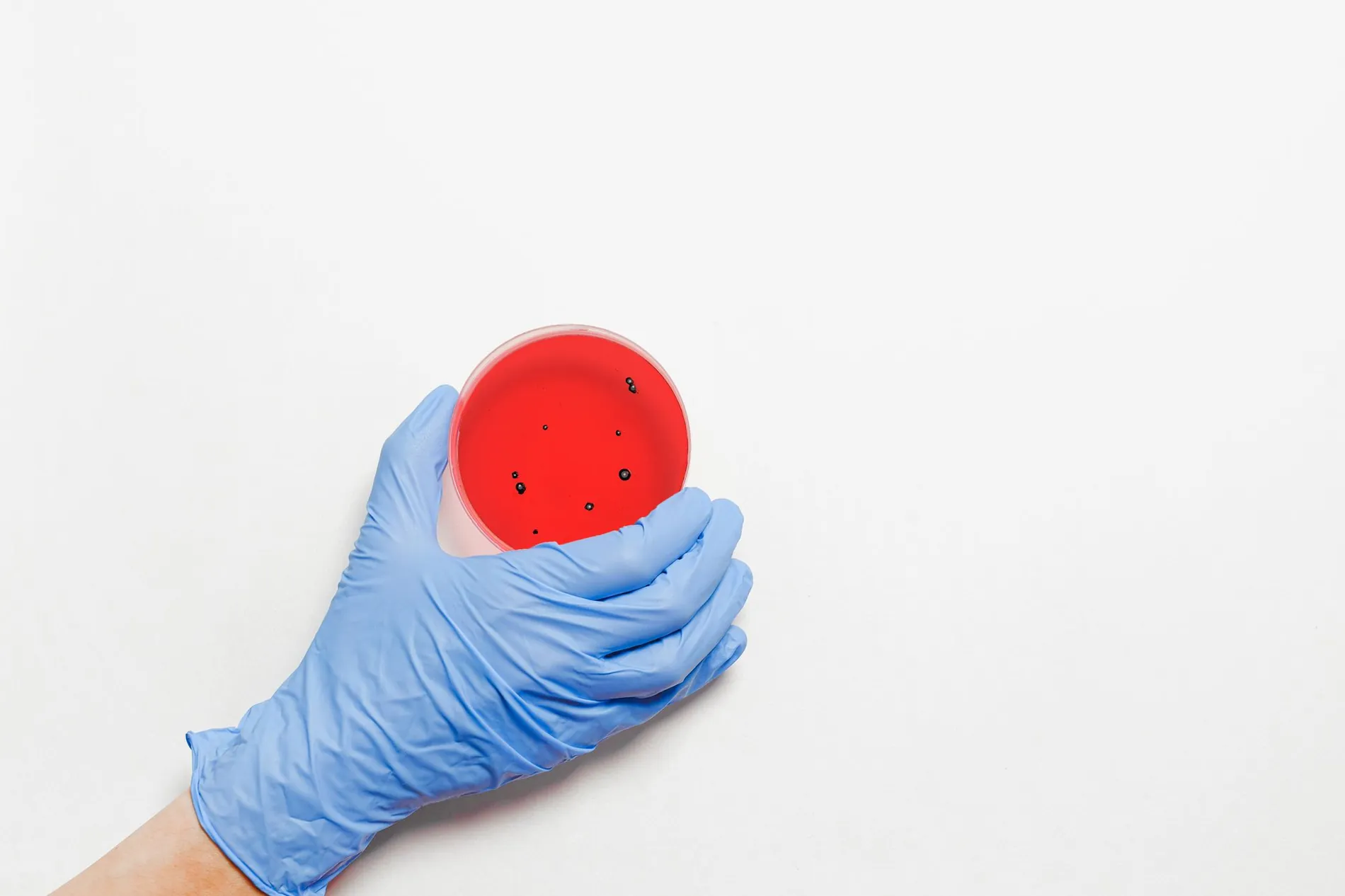 Mesenchymal Stem Cells