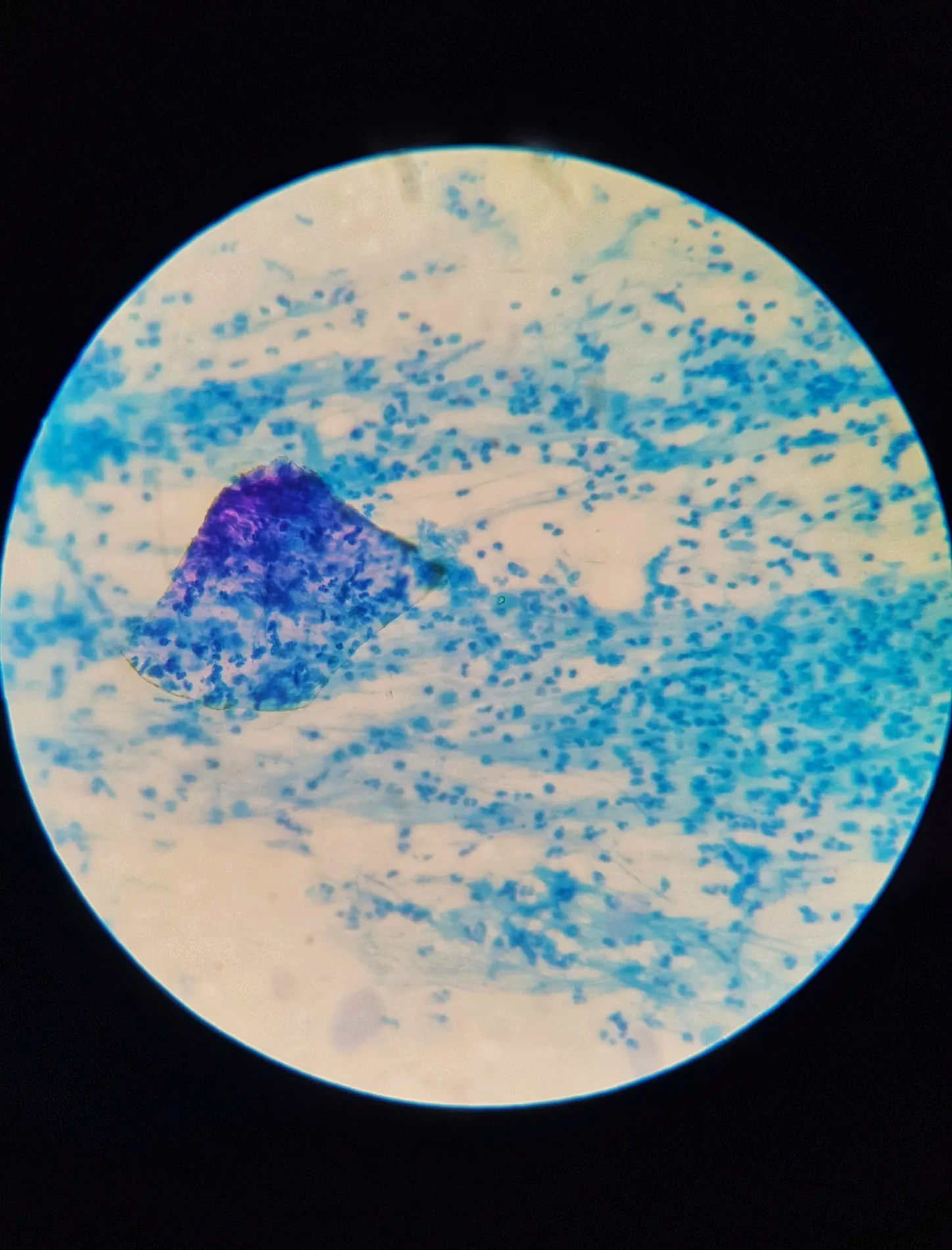 Stained cells viewed through a microscope